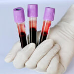 Blood Analysis Melbourne