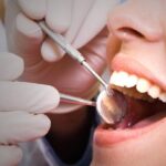 Are You Seeking The Best Adult Dentist In Houston? Uncover The Benefits Of Choosing A PPO Dentist In Houston