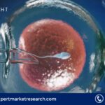 Cryopreservation for In-Vitro Fertilization (Ivf) Market Size, Share, Price, Trends, Growth, Analysis, Report and Forecast 2024-2032