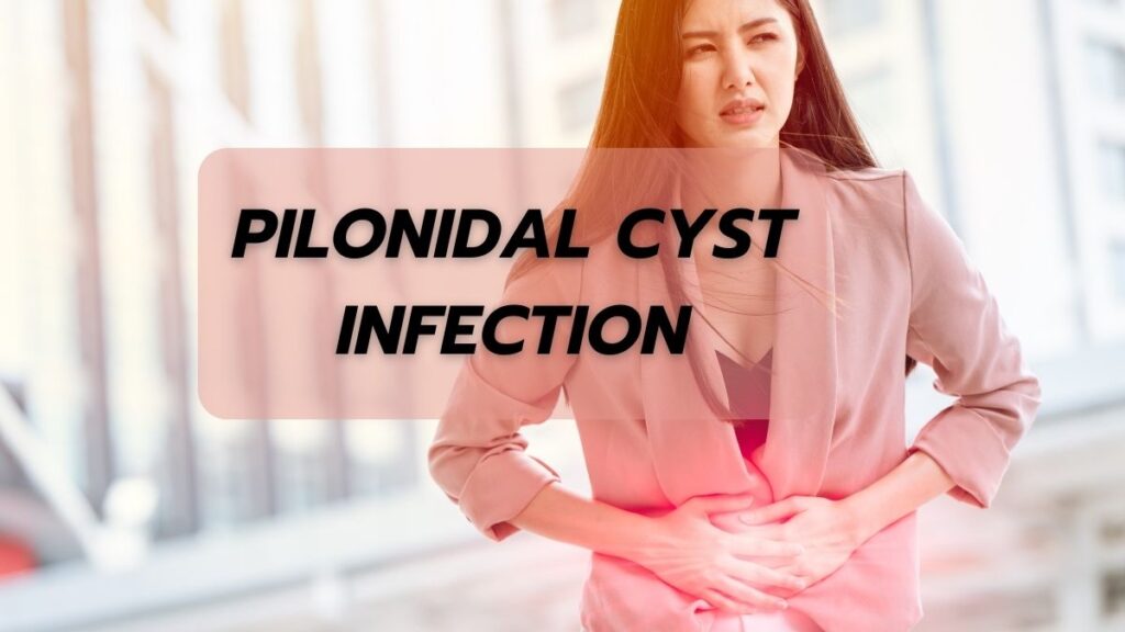 Pilonidal Cyst Infection