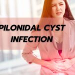 Pilonidal Cyst Infection