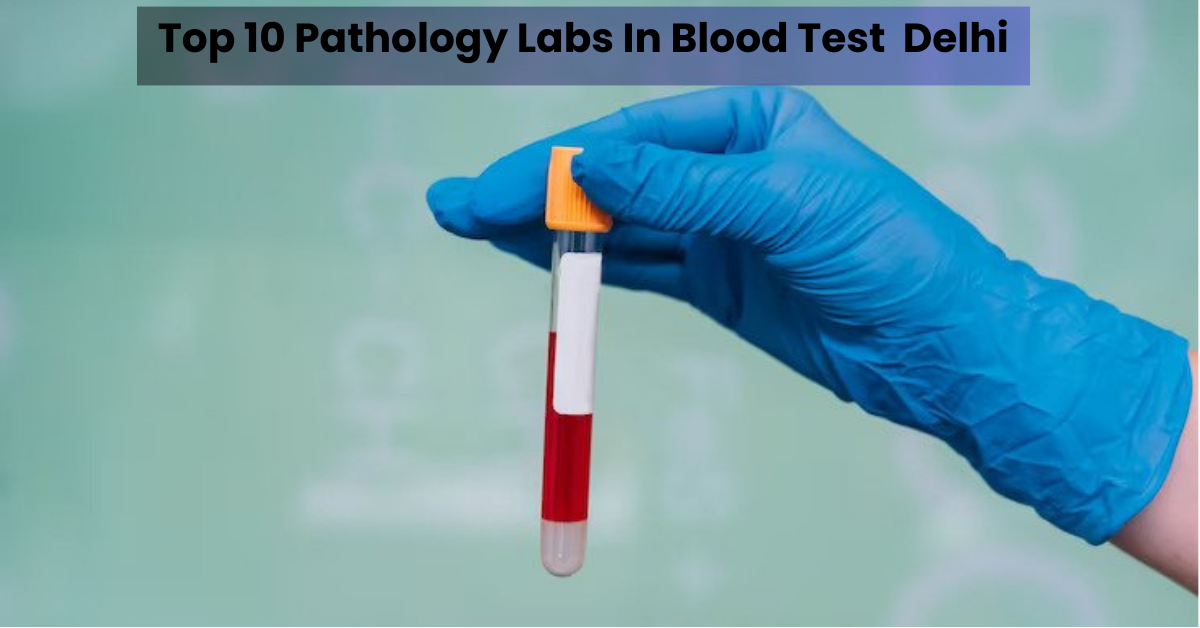 Top-Pathology-Labs-In-Blood-Test-Delhi-