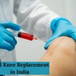 knee replacement surgery