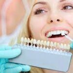 Teeth Whitening Treatment in Aberdeen