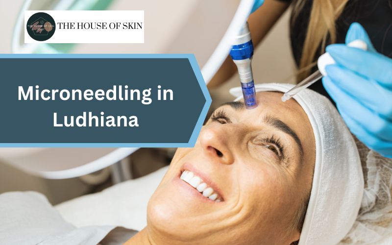 microneedling in ludhiana