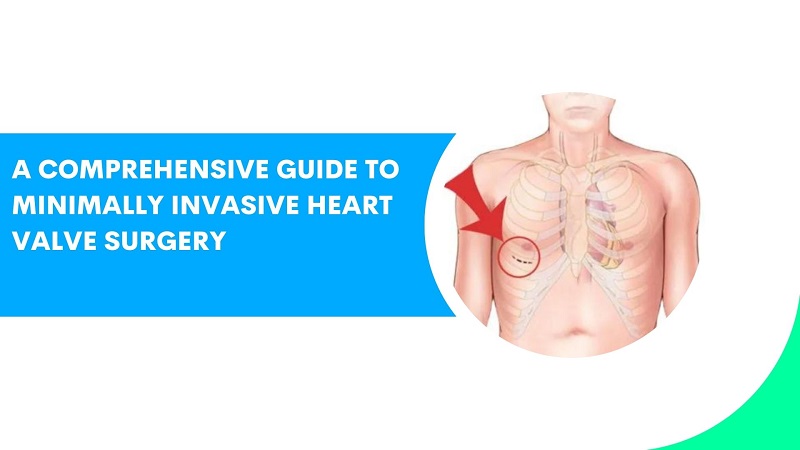 Minimally invasive heart valve surgery 