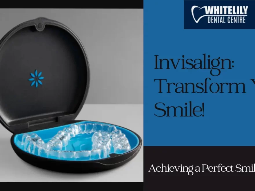 Invisalign Transform Your Smile!