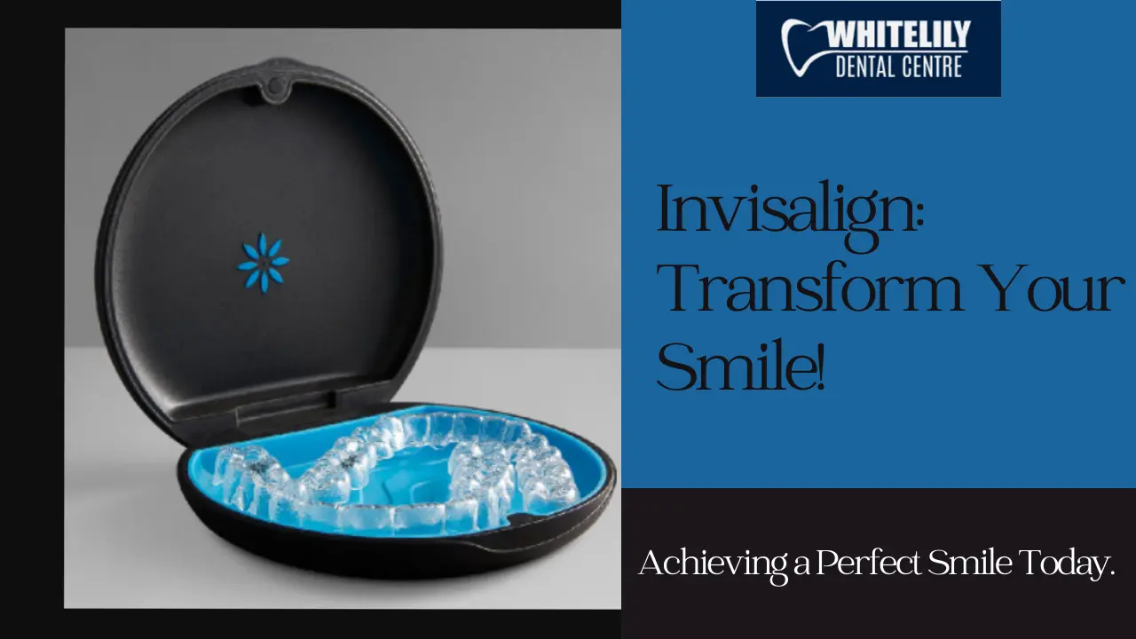 Invisalign Transform Your Smile!