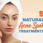 Which medicine is best for acne and acne scars?