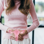 Demystifying PCOS: A Woman’s Guide to Symptoms, Diagnosis, and Treatment