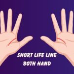 Short Life Line Both Hand