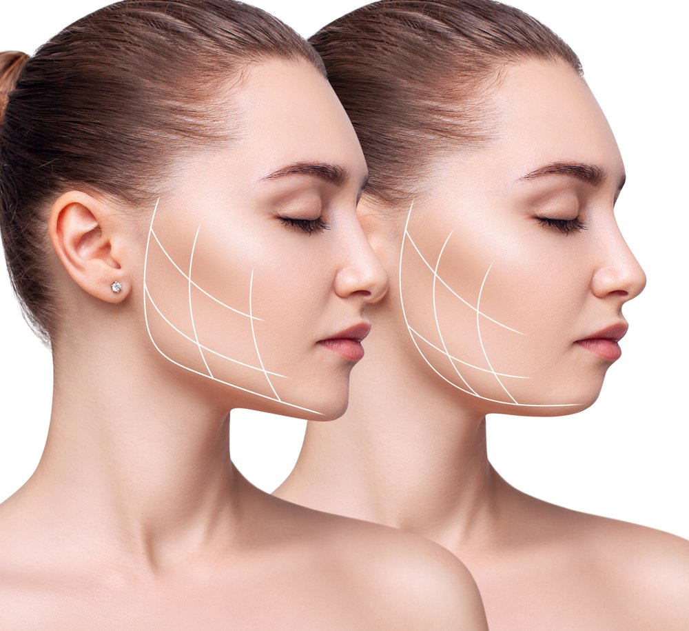 facial rejuvenation