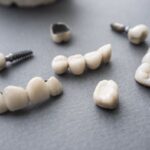 Dental Crowns Fall River