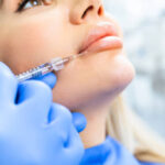 dermal fillers leeds