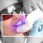 Brighter Days Ahead: Teeth Whitening Services in Riyadh