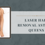 laser hair removal astoria queens