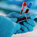 Blood Collection Market Report, Share, Industry Trends, Outlook, 2024-2032