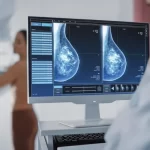 Breast Cancer Screening Market Size, Share and Growth ⅼ Forecast (2023 – 2028) ⅼ Renub Research