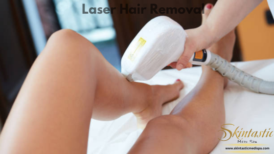 laser hair removal in Riverside