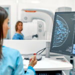 Europe Breast Cancer Screening Market is projected to grow US$ 433.5 Million by 2028