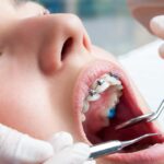 Best Orthodontic Clinics and Dentists in Dubai