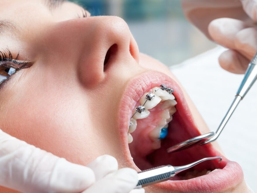 Best Orthodontic Clinics and Dentists in Dubai