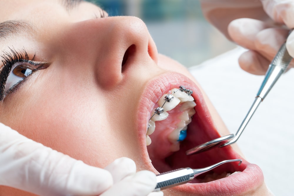 Best Orthodontic Clinics and Dentists in Dubai