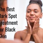 The Best Dark Spot Treatment