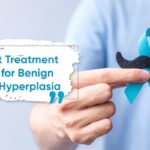 Top 3 Best Treatment Options for Benign Prostatic Hyperplasia