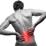 sciatic back pain treatment