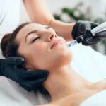 Exploring the Benefits and Process of Microneedling in Las Vegas