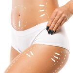 Safety Measures and Benefits of Brazilian Butt Lift in Dubai