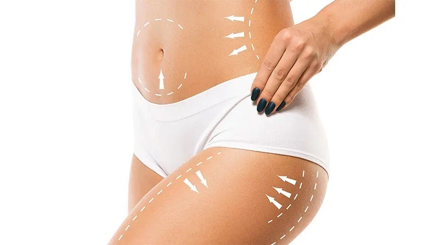 Safety Measures and Benefits of Brazilian Butt Lift in Dubai