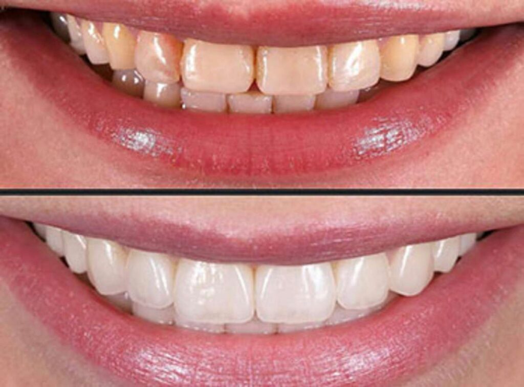 Cosmetic Dentistry Near Me