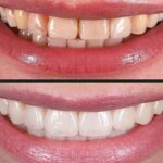 Cosmetic Dentistry Near Me