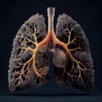 Advancements in Lung Cancer Treatment: A Comprehensive Guide