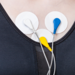 The Global Cardiac Holter monitor market is projected to attain US$ 713.5 Million in 2030