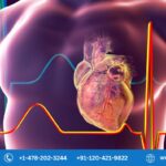 Coronary Artery Disease Market shall be US$ 38.17 Billion by 2028, according to Renub Research