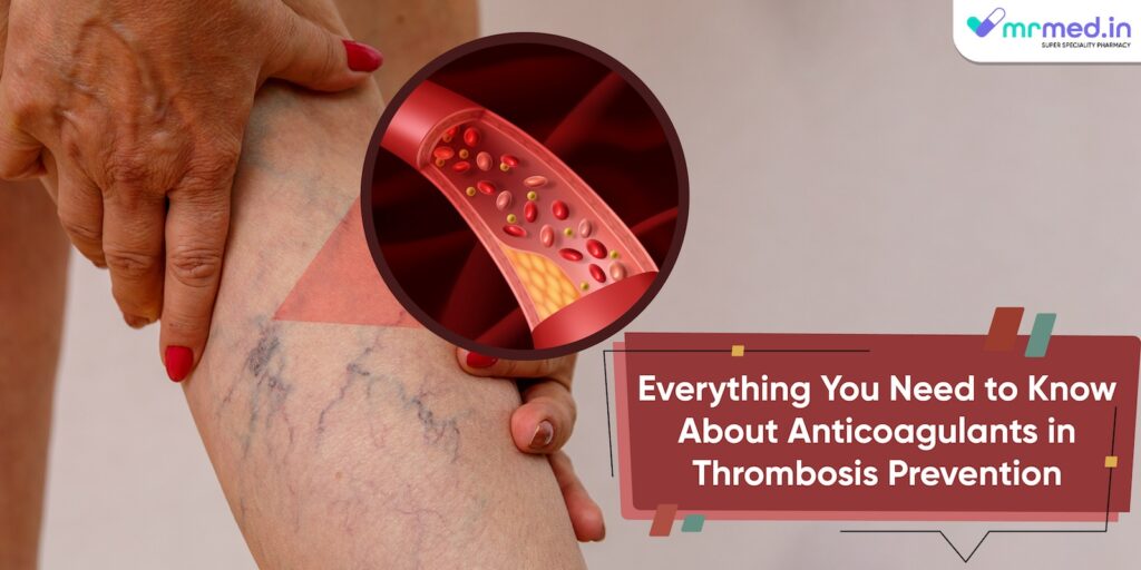 Everything You Need to Know About Anticoagulants in Thrombosis Prevention