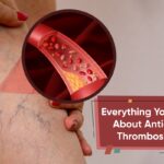 Everything You Need to Know About Anticoagulants in Thrombosis Prevention