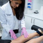 what are the treatment options for varicose veins