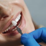 Dental Crowns Fall River