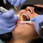 Oral Cancer Screening