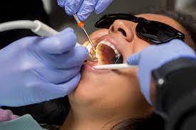 Oral Cancer Screening