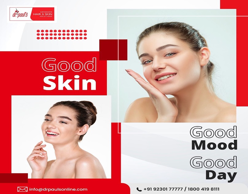 best skin treatment in Kolkata