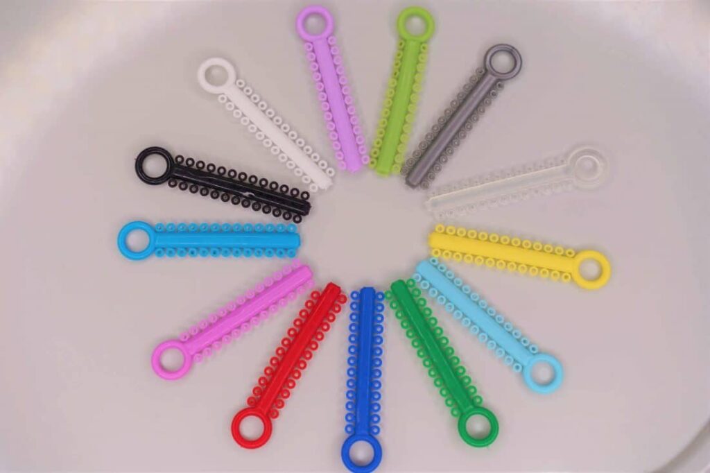 Advantages Of Choosing Braces Color Wheel