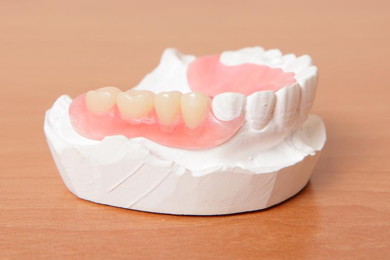 Partial Dentures