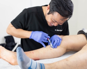 time for spider veins to disappear after laser treatment