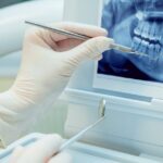 How Do Dental X Rays Assist in Accurate Diagnoses?