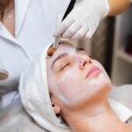 Chemical Peel